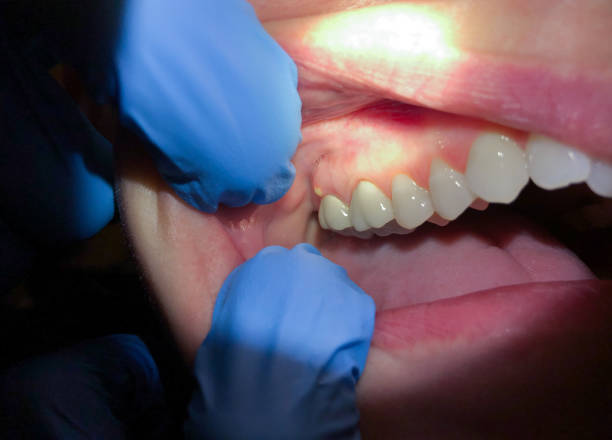 Best Emergency Dentist for Special Needs Patients in Five Points, NC