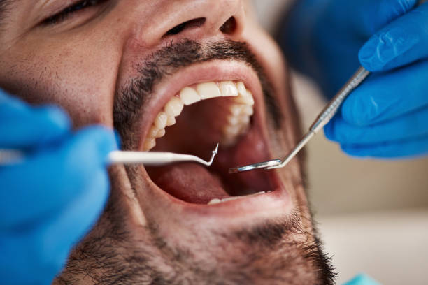 Best Emergency Dental Services for Seniors in Five Points, NC